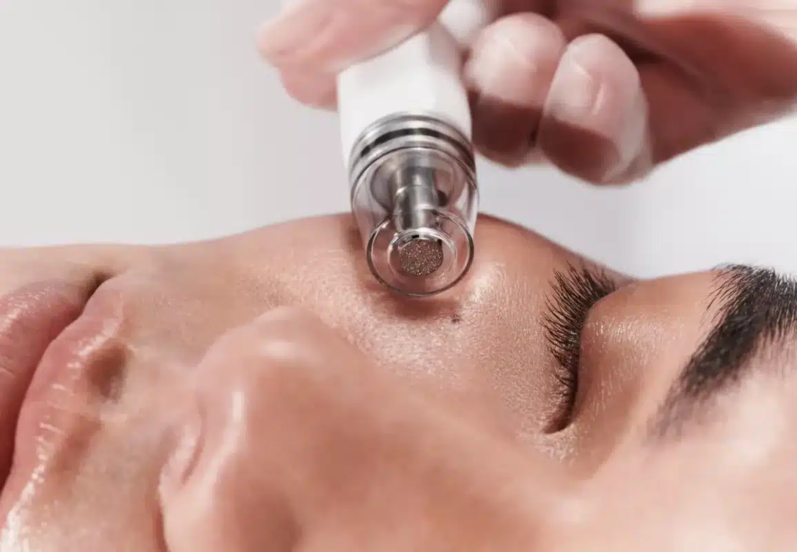 Vida Aesthetics Botox Madison WI | Fillers | Moxi Laser