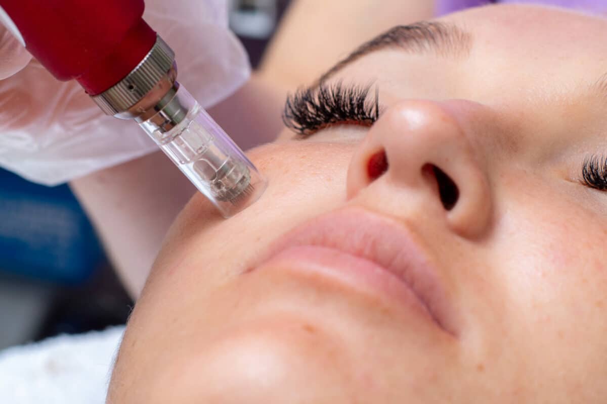 Vida Aesthetics Botox Madison WI | Fillers | Moxi Laser