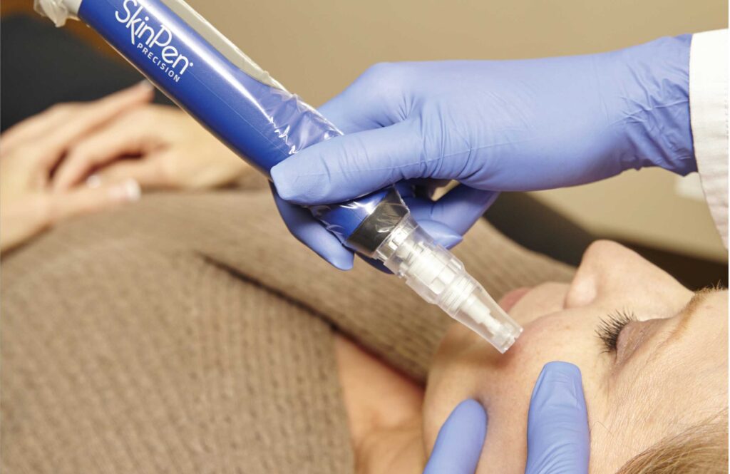 Vida Aesthetics Botox Madison WI | Fillers | Moxi Laser