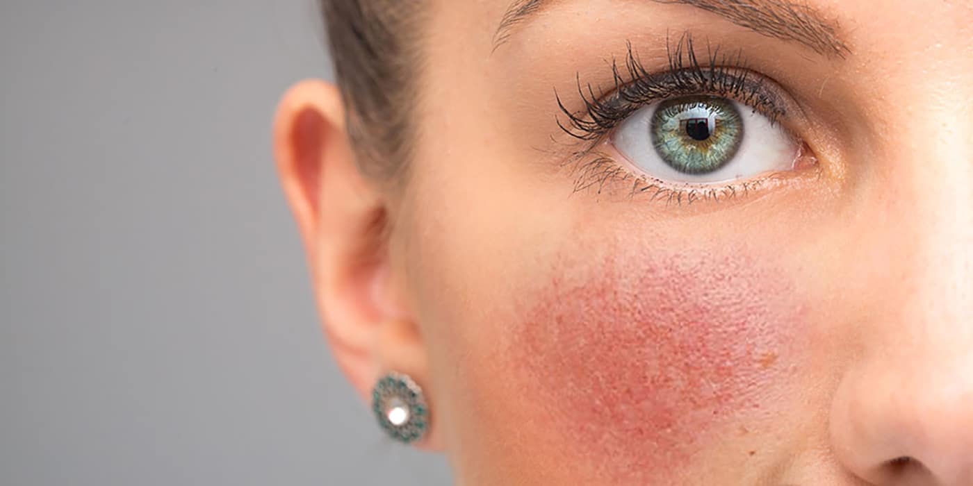 Vida Aesthetics Botox Madison WI | Fillers | Moxi Laser