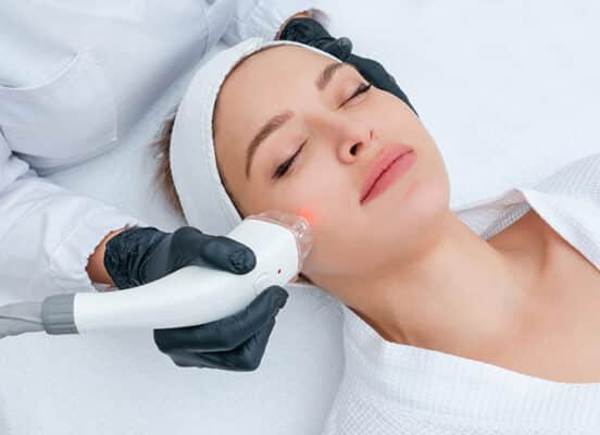 BBL Laser treatment at Vida Aesthetics