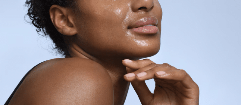 Vida Aesthetic Blog: beautiful woman with hands on chin