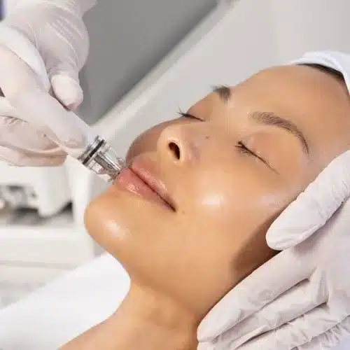 Vida Aesthetics Botox Madison WI | Fillers | Moxi Laser