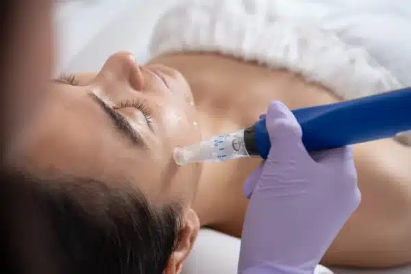 skinpen microneedling at Vida Med Spa
