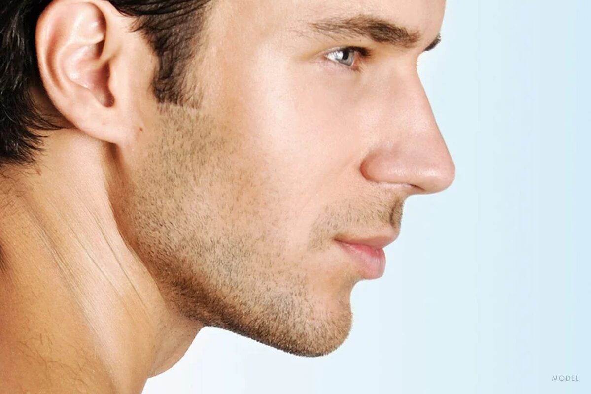 Vida Aesthetics Botox Madison WI | Fillers | Moxi Laser