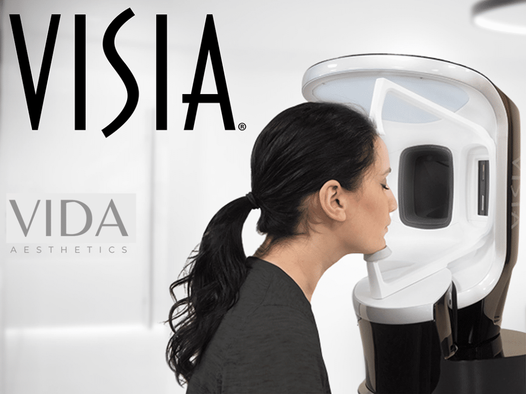 Visia Facial analysis treatment at vida