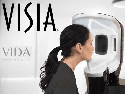 Visia Facial analysis treatment at vida