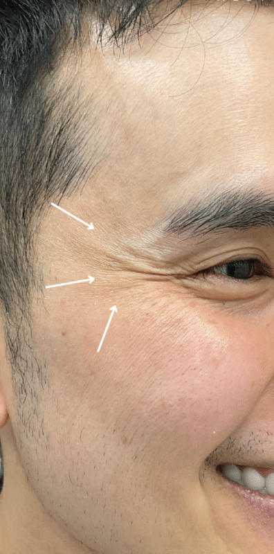 Vida Aesthetics Botox Madison WI | Fillers | Moxi Laser